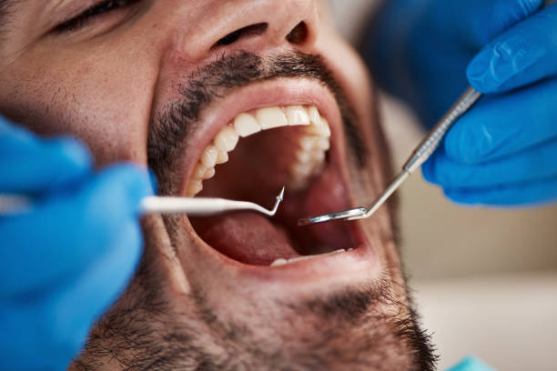 Best Emergency Treatment for Dental Infections or Abscesses in Ashland, WI