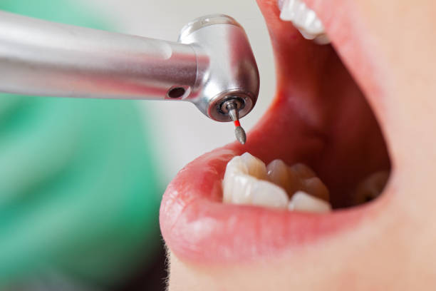 Best Emergency Treatment for Dental Infections or Abscesses in Ashland, WI